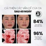  Serum NMF Prebiotics Hỗ Trợ Giảm Đỏ Giảm Sưng Tăng Cường Phục Hồi Bảo Vệ Làn Da MD Care 30ml 