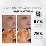  Serum Sáng Da, Chống Lão Hoá MD CARE VitaC-Arbutin 30ml Whitening Advanced Formula 
