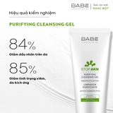  Sữa Rửa Mặt LABORATORIOS BABÉ Stop Akn Purifying Cleansing gel 100ml-200ml Cho Da Dầu Mụn 
