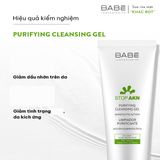  Sữa Rửa Mặt LABORATORIOS BABÉ Stop Akn Purifying Cleansing gel 100ml-200ml Cho Da Dầu Mụn 