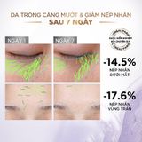  Serum Dưỡng L'Oreal Paris Revitalift 1.5% Hyaluronic Acid Cấp Ẩm Tức Thì, Làm Giảm Nếp Nhăn, Căng Mướt Da 30ml 