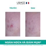  Kem Dưỡng Uriage Hyseac 3 - Regul Ngăn Ngừa Mụn Trứng Cá 40ml 