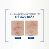  Kem Dưỡng Ducray Keracnyl PP+ Anti-Blemish Cream Giảm Mụn Mờ Vết Thâm 30ml 