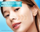  Serum Garnier Bright Anti-Acne Booster Serum Giảm Mụn Mờ Thâm Cho Da Dầu, Mụn 30ml 