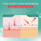  Gel Dưỡng Ẩm Hada Labo Acne Care Calming Gel Cream 50g - Cho Da Mụn, Da Nhạy Cảm, Ngừa Mụn, Làm Dịu Da 