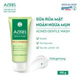  Sữa Rửa Mặt Acnes Kiểm Soát Nhờn,Mụn Acnes Oil Control Cleanser/Creamy Wash/Foaming Wash/Vitamin Cleanser/Gentle 
