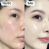  Mặt Nạ BANOBAGI PREMIUM Thế Hệ Mới, Dưỡng Da Chuyên Sâu Dành Cho Mọi Loại Da 30g 