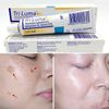  Kem trị nám da Galderma TriLuma Cream Mỹ 15g 