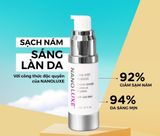  Kem Trị Nám, Tàn Nhang Nanoluxe Dark Spot Remover 20ml 