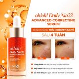  Tinh chất 23% Niacinamide sáng da giảm thâm nám oh!oh! Daily Nia23 Advanced Correcting Serum 