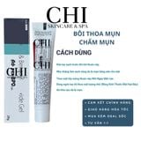  [ Hackss&Slacks ] Adp & Bz.zoyl Krem gel giam mun Apex BOP giảm mụn, giảm thâm hiệu quả -chi2 