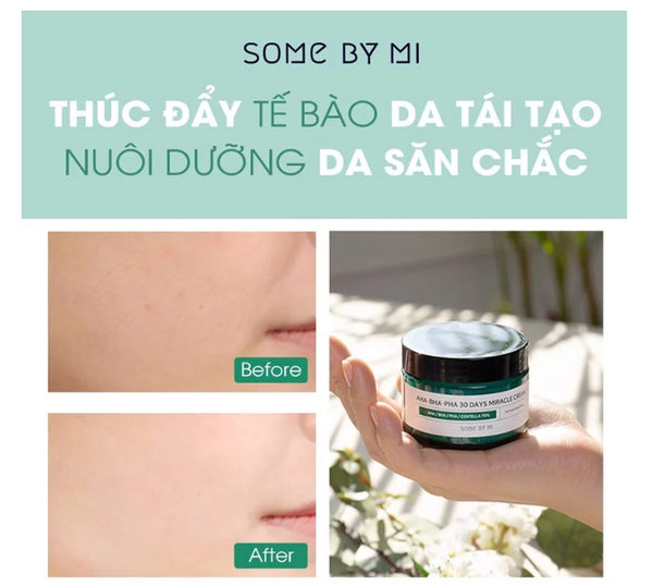 Kem Dưỡng Some By Mi AHA-BHA-PHA Làm Giảm Và Ngăn Ngừa Mụn 60g
