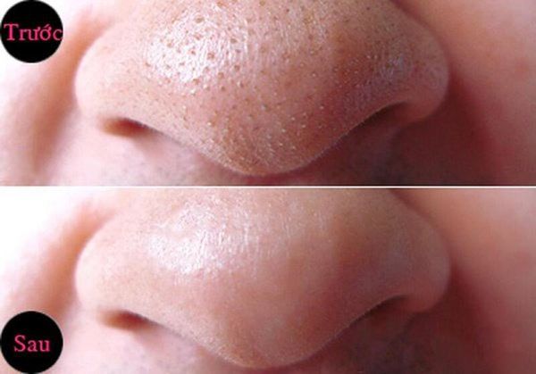Miếng Dán Mũi Lột Mụn Bioré Không Hương (4 Miếng) Pore Pack