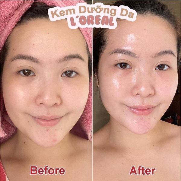 Kem Dưỡng L'Oreal Sáng Mịn Mờ Thâm Nám Ban Đêm 50ml Glycolic-Bright Glowing Cream Night