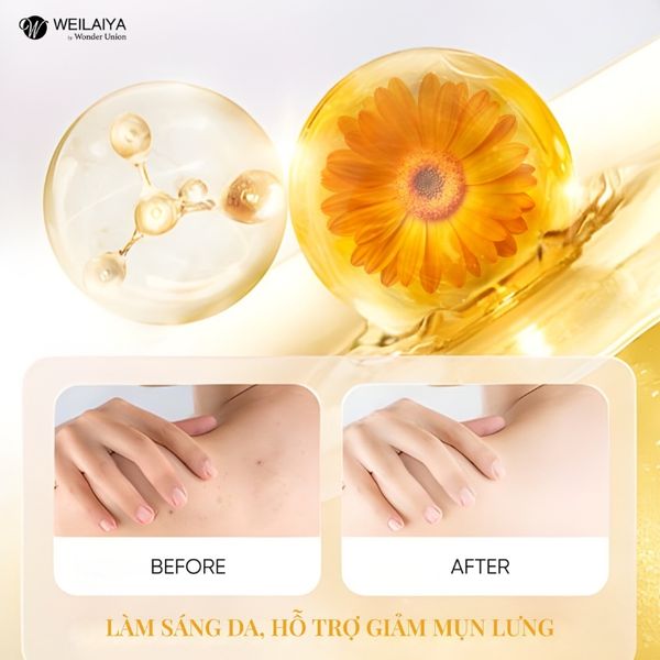 Sữa tắm trắng da cánh hoa cúc Calendula Weilaiya 450ml