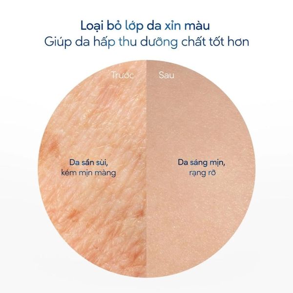 Tẩy Tế Bào Chết Body Dove Hương Việt Quất 280g