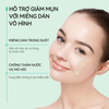 Miếng Dán Mụn Lanbena Invisible Acne Pimple Patch Hỗ Trợ Giảm Mụn, Làm Dịu Da
