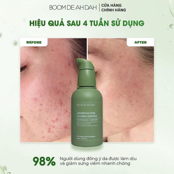 Tinh Chất Làm Dịu, Phục Hồi, Giảm Mụn Boom De Ah Dah Growth Factors Calming Ampoule 50ml
