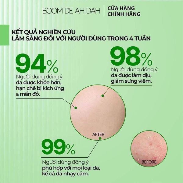 Tinh Chất Làm Dịu, Phục Hồi, Giảm Mụn Boom De Ah Dah Growth Factors Calming Ampoule 50ml