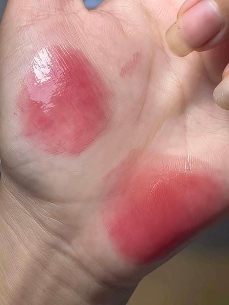 (New Dew) Son Tint Bóng Merzy New Watery Dew Tint