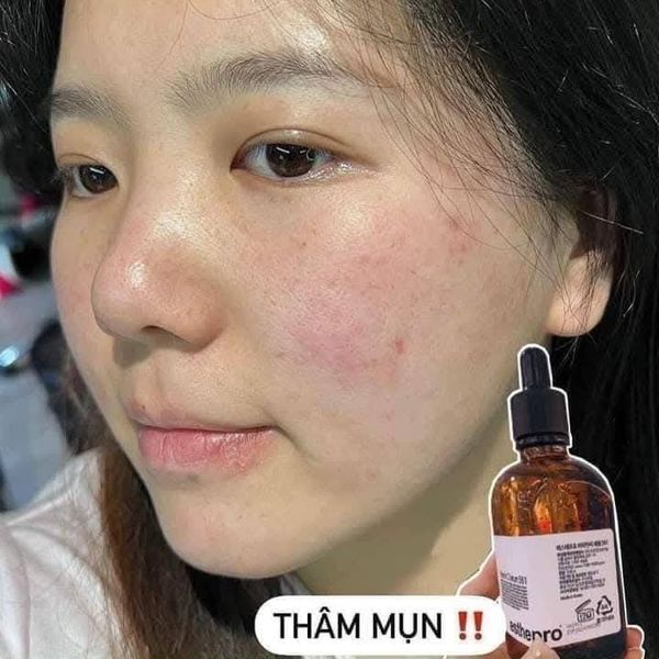 Tinh Chất Dưỡng Trắng, Mờ Thâm Esthepro Vitamin C Serum 561 100ml