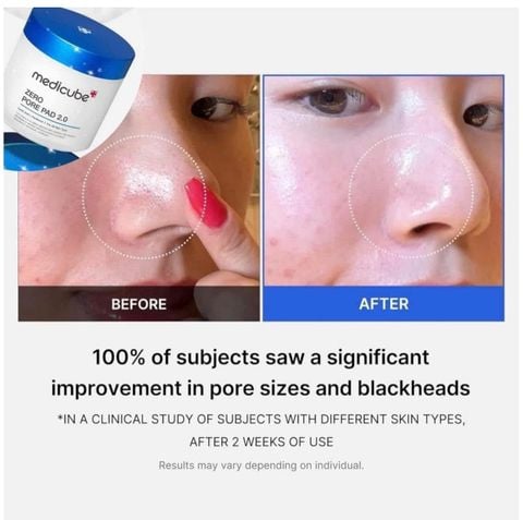 (CÔNG TY) Bông Dưỡng Da Medicube Zero Pore Pad 2.0 155g (70 Pads)