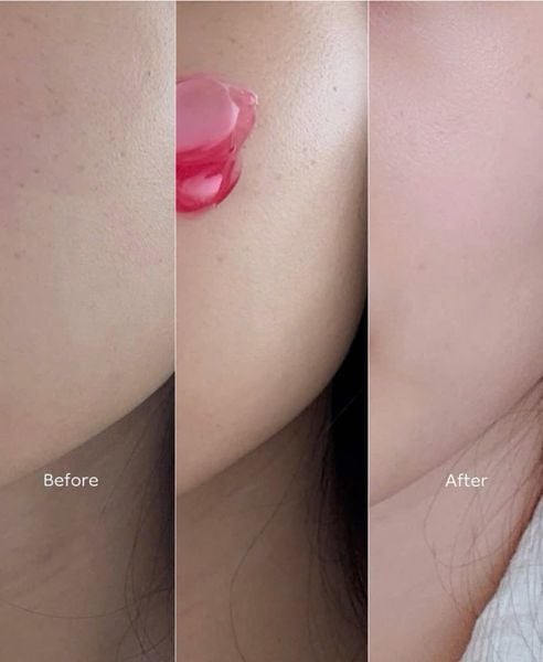 Kem Dưỡng Sáng, Phục Hồi Da Medicube TXA + 5% Niacinamide Capsule Cream 55g