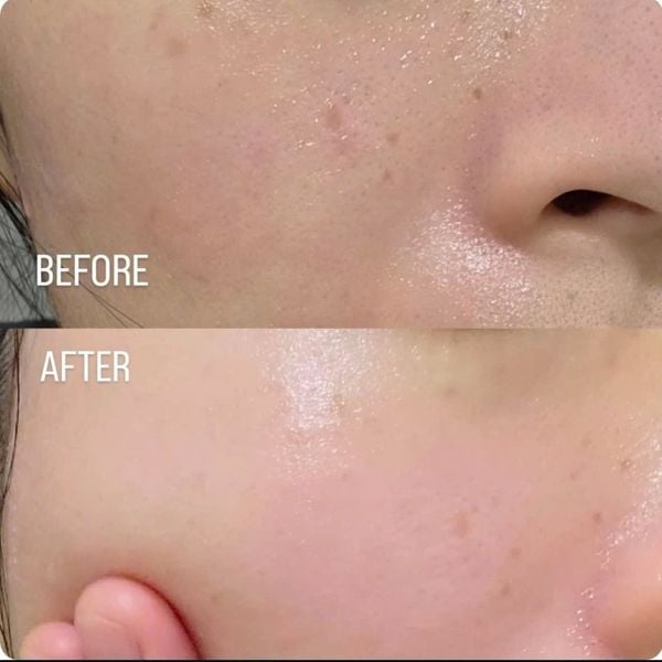 Kem Dưỡng Sáng, Phục Hồi Da Medicube TXA + 5% Niacinamide Capsule Cream 55g