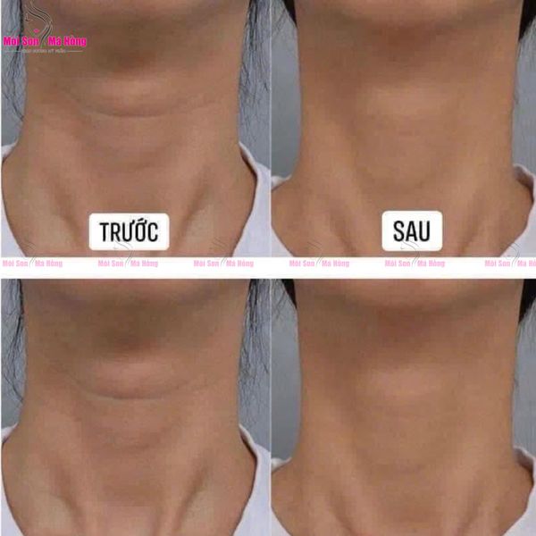 Kem Dưỡng Chống Lão Hóa Vùng Da Cổ Vella Ultimate Age Killer Neck Cream 50ml