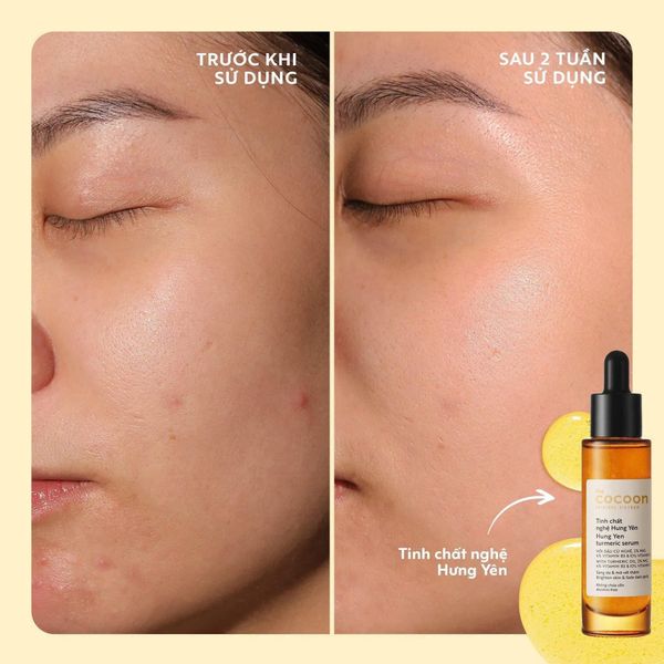 Tinh Chất Dưỡng Sáng Mờ Thâm Nghệ Hưng Yên Cocoon Turmeric Serum C10 30ml