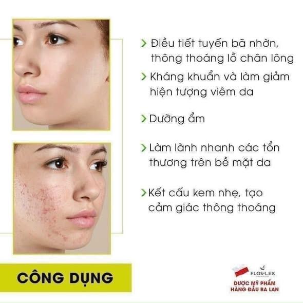 (CÔNG TY) Chấm Mụn Floslek Anti Acne Spot Gel For Imperfections 20ml