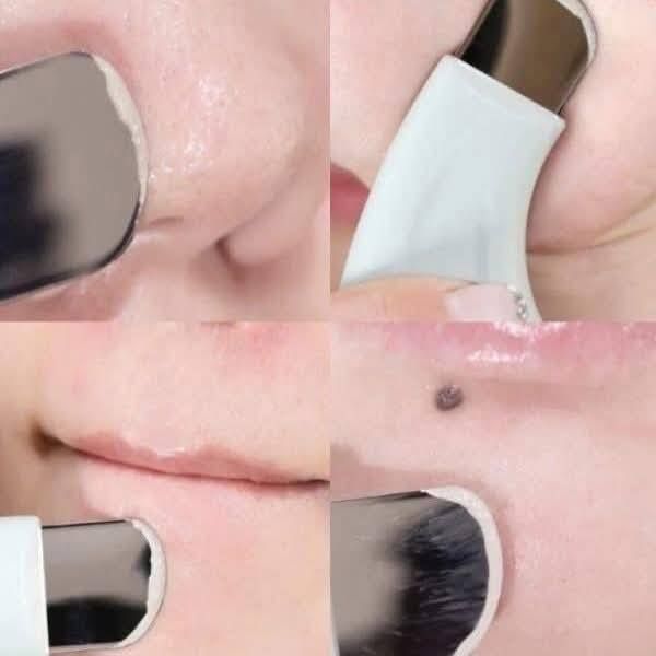 Dụng Cụ Làm Sạch Mụn Đầu Đen ILSO Deep Clean Master