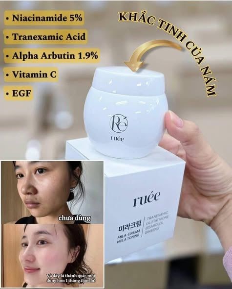 Kem Dưỡng Sáng Da Mờ Nám RUÉE Mila Cream Mela  50g