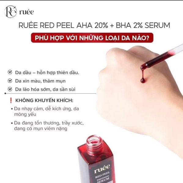 Tinh Chất Serum Peel Da RUÉE Red Peel Whitening Serum 30ml – Chăm Sóc Da Hằng Ngày