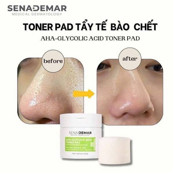 Nước Hoa Hồng Dưỡng Ẩm, Tẩy Tế Bào Chết, Giảm Mụn SenaDemar AHA-Glycolic Acid Toner Pad Hàn Quốc 70 miếng