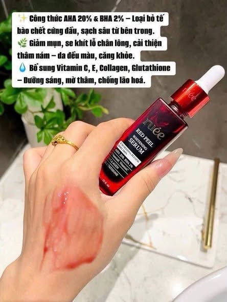 Tinh Chất Serum Peel Da RUÉE Red Peel Whitening Serum 30ml – Chăm Sóc Da Hằng Ngày