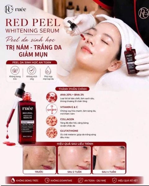 Tinh Chất Serum Peel Da RUÉE Red Peel Whitening Serum 30ml – Chăm Sóc Da Hằng Ngày