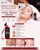 Tinh Chất Serum Peel Da RUÉE Red Peel Whitening Serum 30ml – Chăm Sóc Da Hằng Ngày