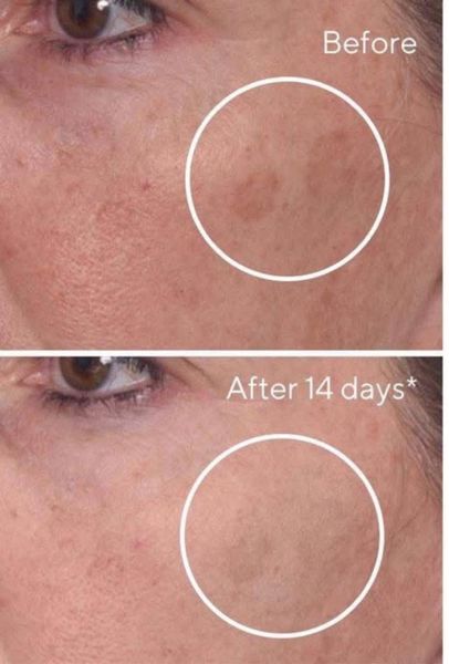Serum Giảm Thâm Nám Murad Rapid Dark Spot Correcting - Làn Da Sáng Mịn, Ngăn Ngừa Đốm Nâu