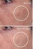 Serum Giảm Thâm Nám Murad Rapid Dark Spot Correcting - Làn Da Sáng Mịn, Ngăn Ngừa Đốm Nâu