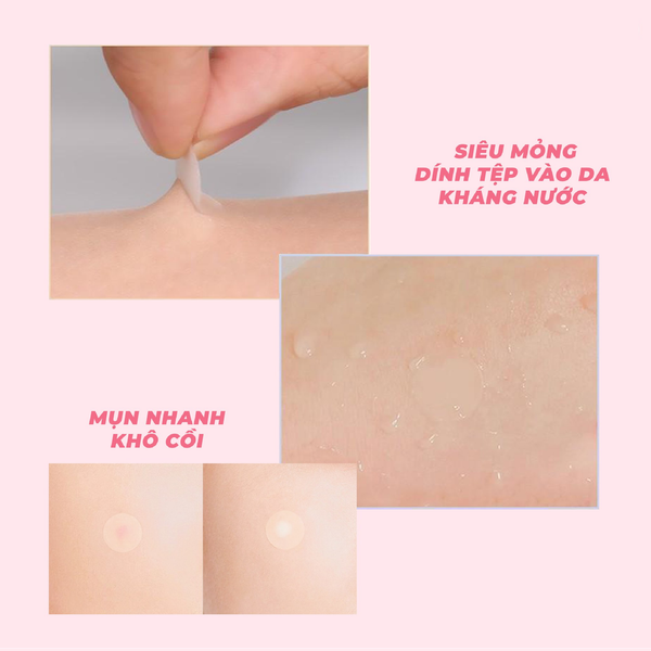 Miếng Dán Mụn Dr.G A'Clear Ultra Thin Spot Patch - 30 Patches