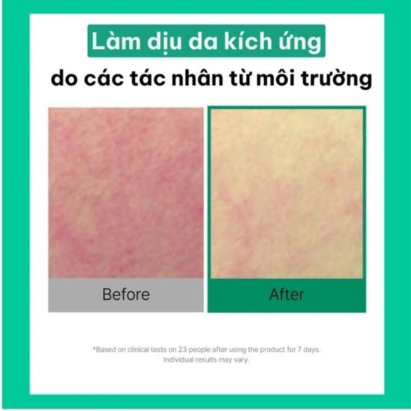 Toner Pad hạ nhiệt giảm mụn & làm dịu da Cell Fusion C CICA Cooling Pad 70 miếng