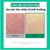 Toner Pad hạ nhiệt giảm mụn & làm dịu da Cell Fusion C CICA Cooling Pad 70 miếng