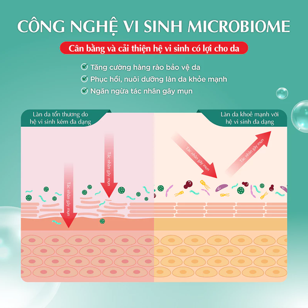 Gel Dưỡng Ẩm Hada Labo Ngừa Mụn, Làm Dịu Da 50g Acne Care Calming Gel Cream