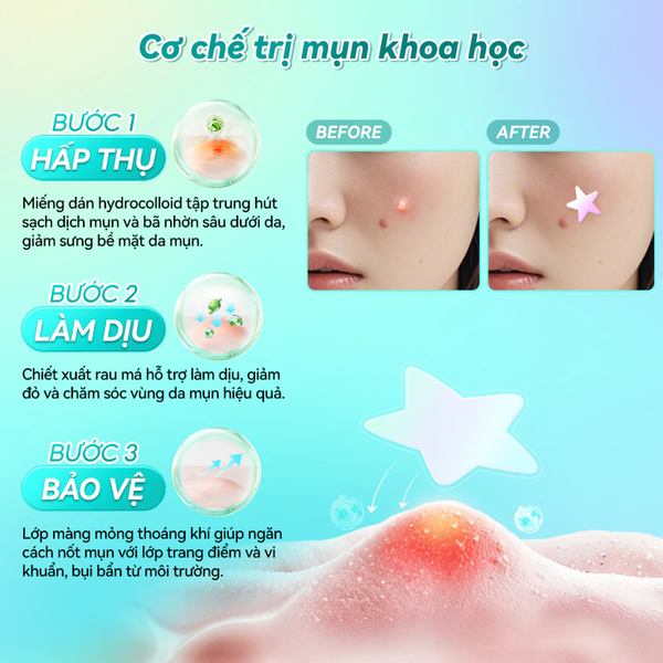 Miếng Dán Mụn Lanbena Invisible Acne Pimple Patch Hỗ Trợ Giảm Mụn, Làm Dịu Da