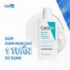 Sữa Rửa Mặt CeraVe Giúp Ngừa Mụn 236ml