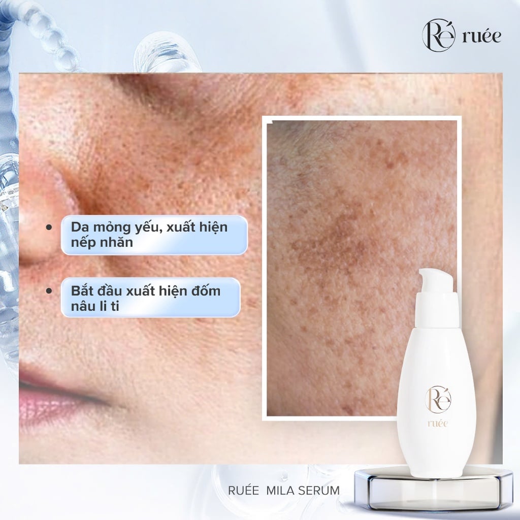 Tinh Chất Sáng Da, Mờ Thâm Nám, Cải Thiện Nếp Nhăn RUÉE Mila-Serum Retinol 50ml