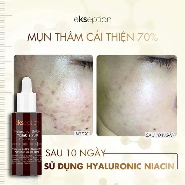 Tinh Chất Hỗ Trợ Giảm Mụn Xóa Thâm Ekseption Hyaluronic Niacin Mixlab 75ml