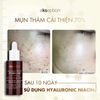 Tinh Chất Hỗ Trợ Giảm Mụn Xóa Thâm Ekseption Hyaluronic Niacin Mixlab 75ml