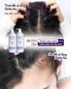 Bộ Dầu Gội Và Dầu Xả 2in1 Trị Gàu & Kiềm Dầu Biotin & Collagen Voudioty 1000ml (Tím)